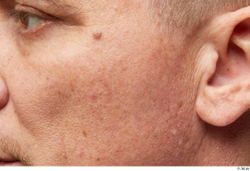 Face Cheek Ear Skin Man White Wrinkles Studio photo references